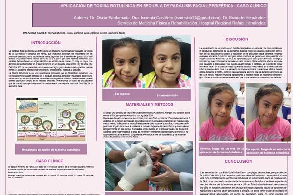 cartelaplicaciondetoxinabotulinicav03
