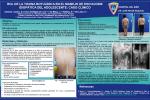 cartelroldelatoxinabotulinicav03